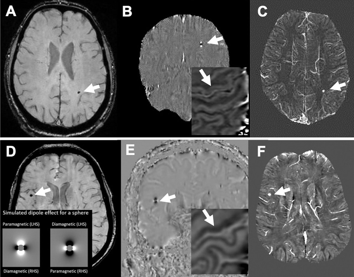 American Society of Pediatric Neuroradiology tweet media