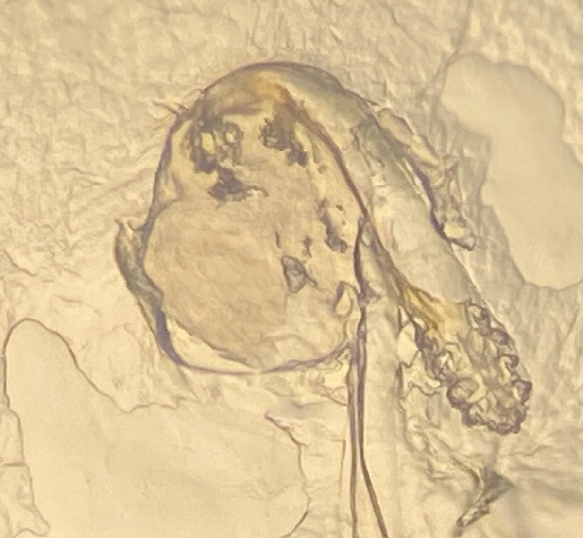 SheriHincks's tweet photo. Face mites! We all have them. They eat, poop and have sex on our face. We have now scanned 145 nasal strips that the students in #ZOO2700 sent us and taken photos of all their mites. Now they will be barcoded. #demodex #miteclub. Thanks @uogcoesp for the financial support. https://t.co/4wrcDK2aAE