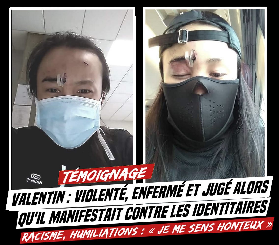 VALENTIN : VIOLENTÉ , ENFERMÉ  ET JUGÉ  ALORS QU'IL MANIFESTAIT CONTRE LES IDENTITAIRES

- Racisme, fouille à nu, humiliations et violences en garde à vue : «je me sens honteux» - 

#ViolencesPolicières #ÉtatPolicier #SociétéCarcérale #Milice #Racisme #IdentitairesEnUniformes