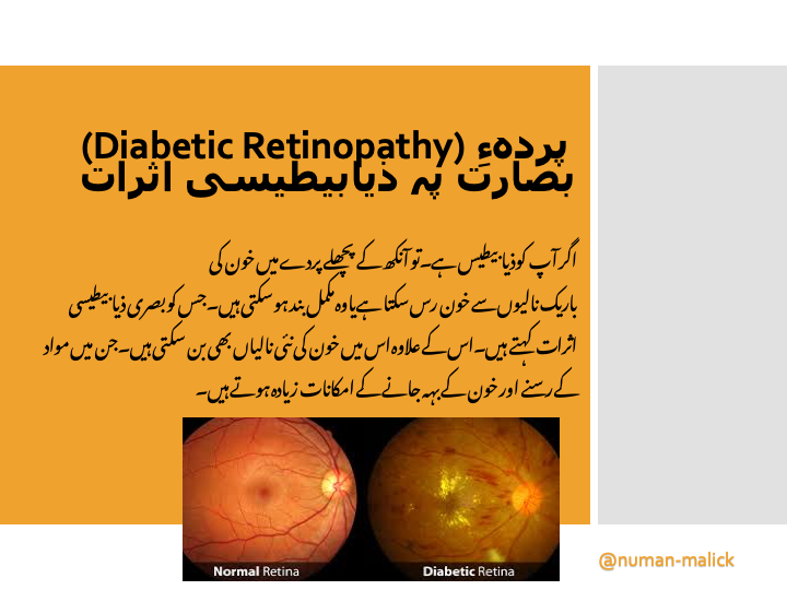 EyeHealthTips1 tweet picture