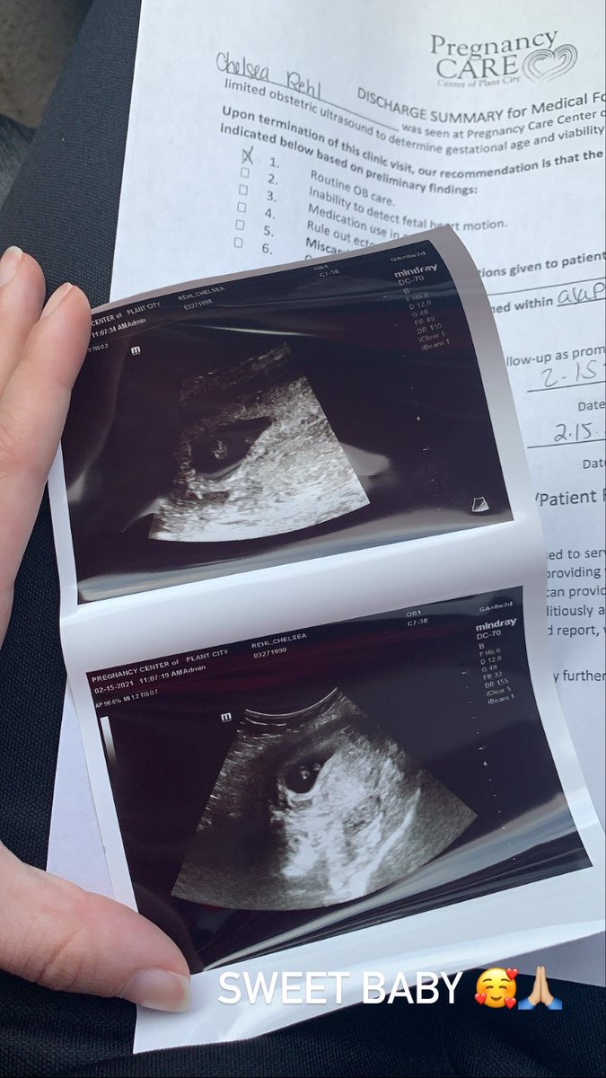 ClouttPrincess's tweet photo. Baby Beasley #2 🙏🏼💘 https://t.co/yzmxJMaOcJ