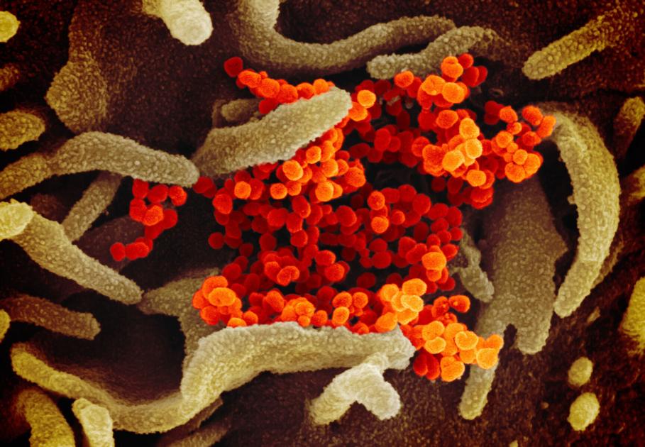 WFSBnews's tweet photo. Covid-19 antibodies may protect against reinfection later, study suggests https://t.co/6bJBf73iSP https://t.co/p7VN210VPY
