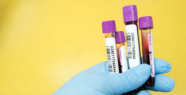 Previous detection methods usually involved blood samples being collected from people who were already diagnosed.

Read the full article: New Blood Test Can Detect Cancer Years Before Symptoms Appear
▸ lttr.ai/dg53

#BloodTest #EarlyDetection #DetectMalignantTumors
