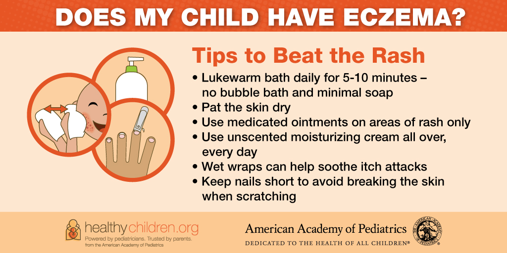 healthychildren's tweet photo. The itchy rash of eczema can be very uncomfortable for kids. Check out these tips to help relieve your child’s discomfort:  https://t.co/MlAZYKVQ5A https://t.co/MaNesPf7P1