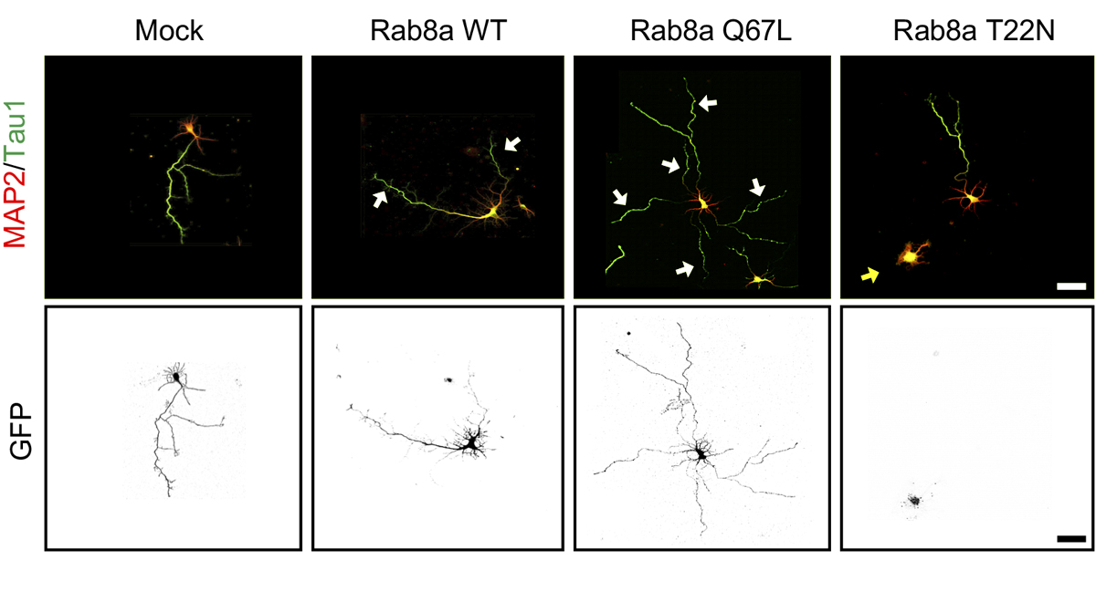 Many proteins help to transform a spherical neuroblast into a complex neuron w/ properly oriented axon and dendrites. This Week <a href="/SfNJournals/">SfN Journals</a> <a href="/pam_urrutia/">Pamela</a> &amp;al identify 2 such proteins: Tuba, which activates Cdc42, and Rab8a, which guides vesicle traffic.
bit.ly/TWIJ022421