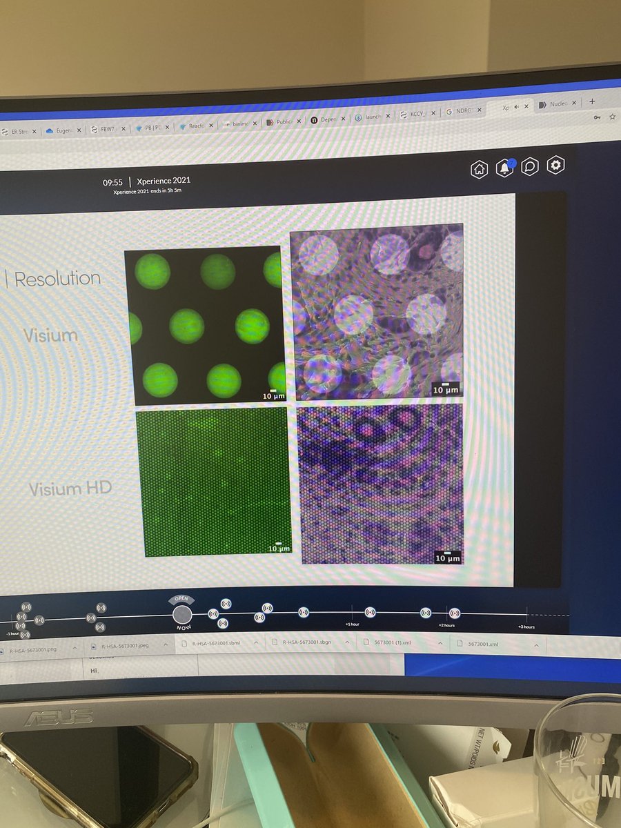 Looking forward for #VisiumHD  getting closer to in situ cell resolution! #Xperience10x  @10xGenomics