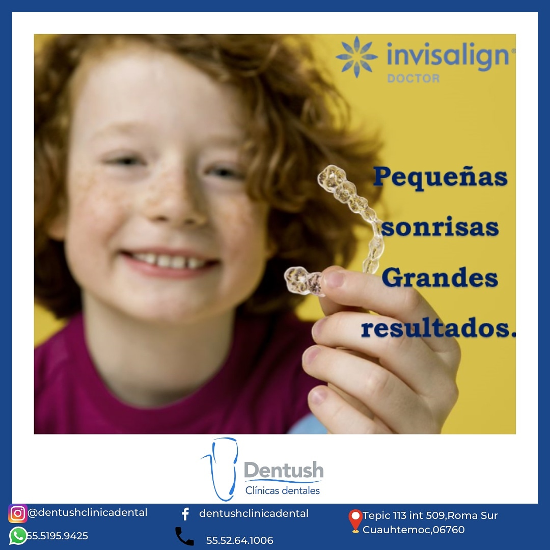Dentushoficial's tweet image. Tratamiento altamente estético cómodo y hecho #atumedida   ven con tus pequeños para ellos también tenemos grandes opciones #dentushclinicadental #invisalignexperience #invisalignsmile #consultorioodontologico #ortodonciainvisible  #ivisaligndoctor