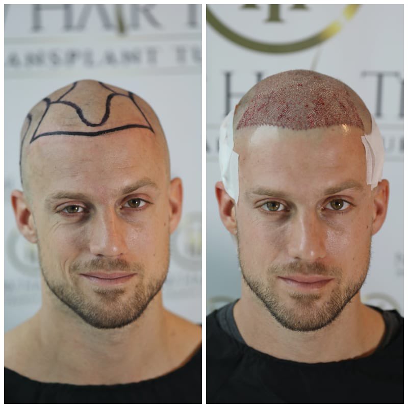 Now Hair Time on Twitter: Now Hair Time on Twitter: