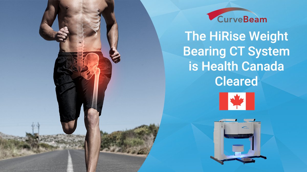 CurveBeamAI's tweet photo. Weight bearing CT imaging of the hip &amp; pelvis is now available in Canada. https://t.co/5Ms9aMf0pc