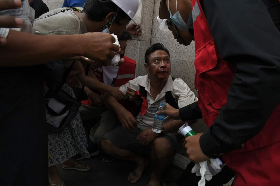 tw // blood,  violence 
In the morning of February 25 , A group of Military supporters attacked nearby people with machetes and sticks in the Thein Phyu railway near in the Yangon's main station. The violence has left some civilians with head injuries. #WhatsHappeningInMyanmar