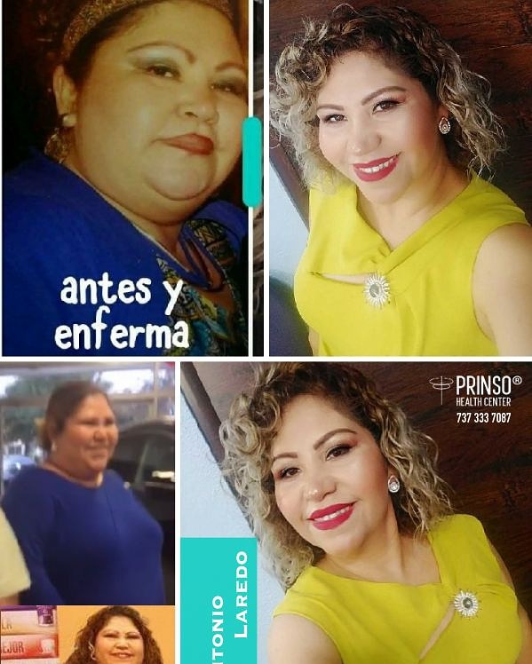 PrinsoHC's tweet photo. El #ProgramaPrinso le ayuda a resolver el problema de fondo del #Sobrepeso y evitar o mejorar la #Diabetes, #PresiónAlta y #ProblemasDelCorazon. 
#PrinsoAustin  #PrinsoSanAntonio #CapsulasPrinso 
 https://t.co/9gQOEI0lKX 737 333 7087 https://t.co/J86AjB5gTC