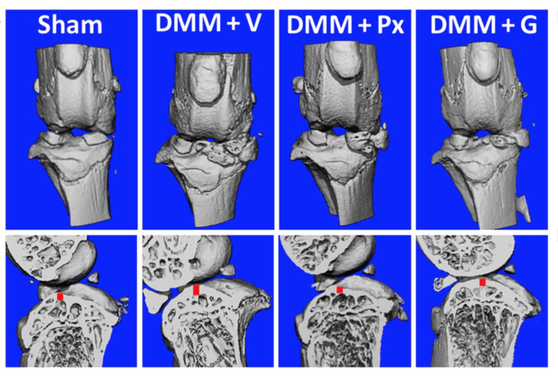 ScienceMagazine's tweet photo. The FDA-approved antidepressant #paroxetine can halt the progression of #osteoarthritis and regenerate damaged cartilage in the joints of mice, according to a new study from @ScienceTM. ($) https://t.co/oy6ImvxiTi https://t.co/8jvoEN6xkq