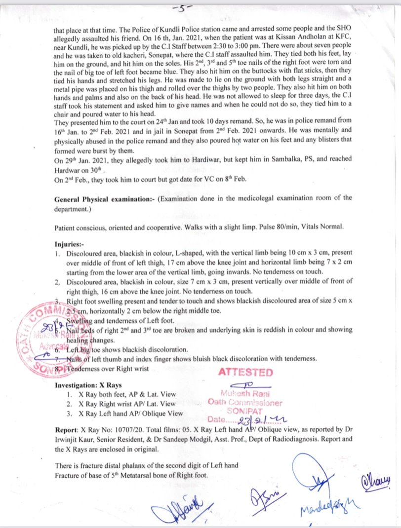 Article14live's tweet image. Multiple fractures. Torn toe nails. Psychological distress. Over 40 days,  #ShivKumar—visually challenged colleague of labour organiser #NodeepKaur—“mentally &amp;amp; physically abused in the police (sic) remand”: report from govt doctors. By @anumayhem article-14.com/post/dalit-lab…