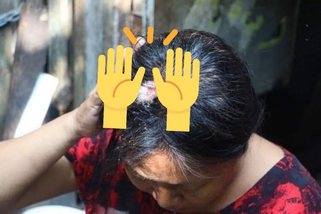 DandanieMyanmar's tweet photo. TW // Wounds &amp; Blood !! 

Dozens of thugs attack 
the residents inside a Myanma railway's residential quarter this morning in February 25.

REJECT MILITARY COUP

#Feb25Coup 
#WhatsHappeningInMyanmar https://t.co/eQU7xzOxXd