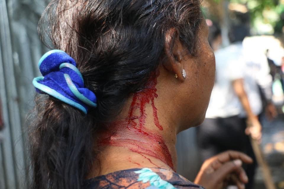 moemoe25204769's tweet photo. #WhatsHappeningInMyanmar 
#save_myanmar https://t.co/vbp6vRsksx
