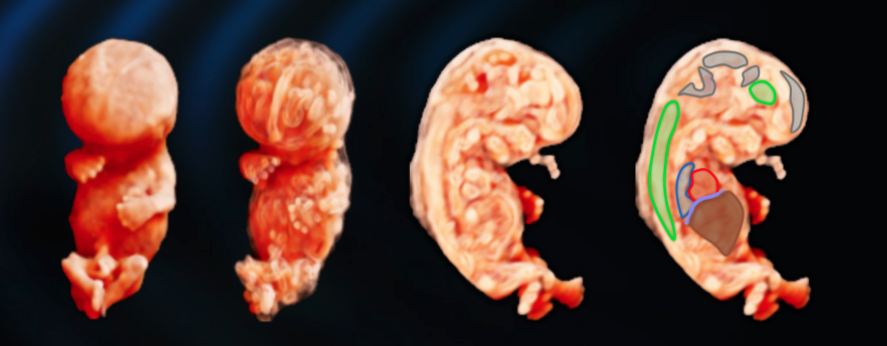 Harsha_Shah86's tweet photo. THE https://t.co/Ivxvo9O9RM IS LIVE! A 3D ultrasound image library for clinicians, created with embryologists, to help unlock the potential of novel rendering applications &amp; facilitate their clinical implementation. 
@proftombourne @ImperialMDR @ISUOG @tommys @MayaAlmemar https://t.co/y8kAafvjEu