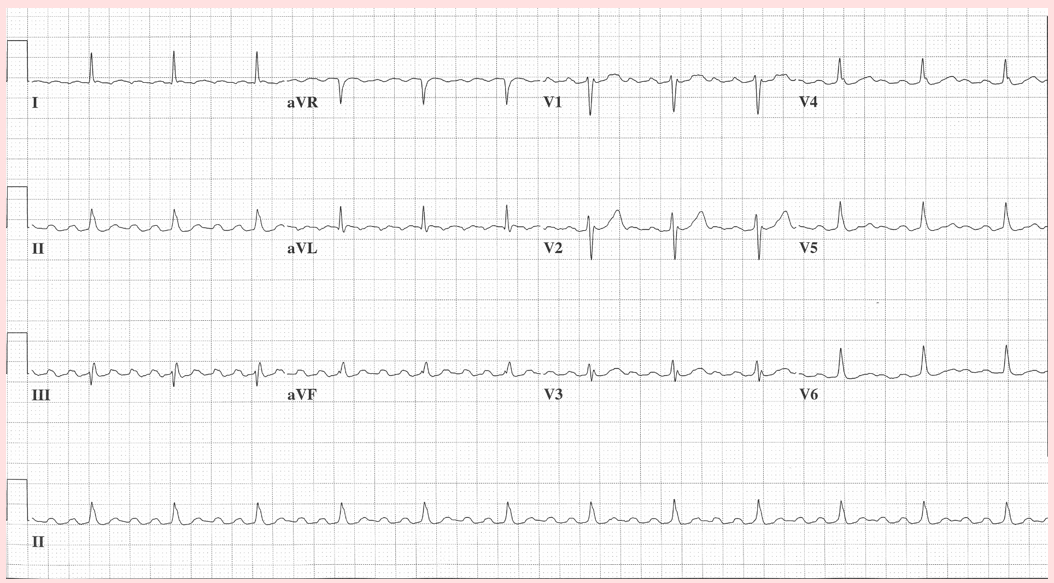CardioNerds tweet media
