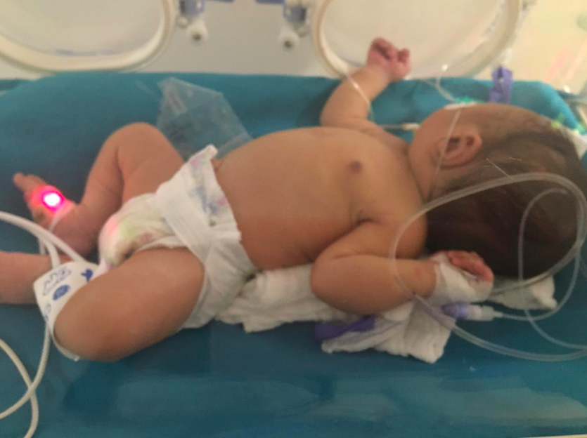 dariomendozaa's tweet photo. Alejandro necesita un RT y ayuda de @Supersalud. Tuvo sufrimiento fetal por mal procedimiento de profesionales en @GClinicaMedicos "@GCuidandoGente" en #Valledupar, hoy requiere atención prioritaria especializada. cc @FabioUCD @PersoneriaVpar @defensoria https://t.co/4n9IbNfaaH