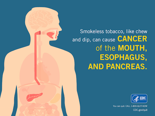 DoD_DHA's tweet photo. The Great American #SpitOut occurs each February to raise awareness of the dangers associated with smokeless tobacco. Smokeless tobacco increases the risk of oral cancer and is just one way to ruin your #DentalHealth: https://t.co/yWnHlSwjsS. https://t.co/XhjCvNzi7C