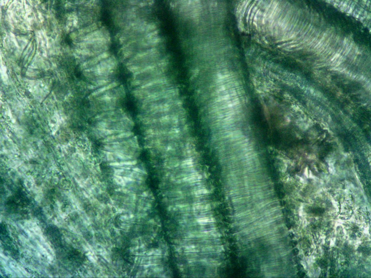 JonHaleBio's tweet photo. This is still one of our favourites. Seeing the lignin spirals in rhubarb with methylene blue #PAG1 @OCR_Science @AchilleosMs #chatbiology https://t.co/DhcORe7M6p