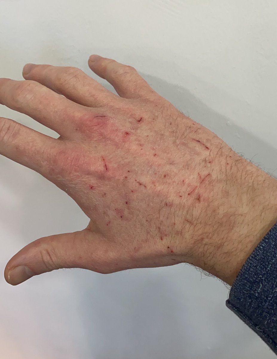 The cat attacked my hand, playing, which was cute when she was just weeks old, but now at 1 she rips my hand to shreds. 

I could do my putting a stop to this 🤣