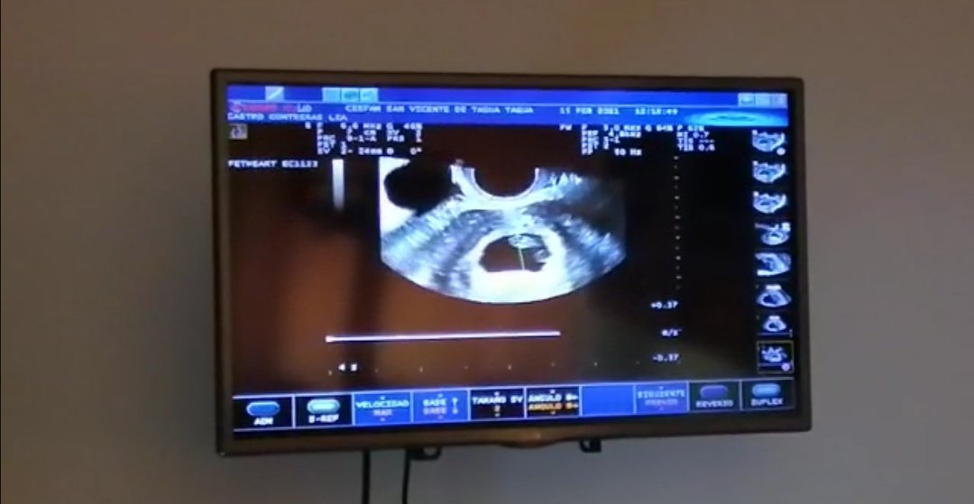 Daniel Alejandro tweet media