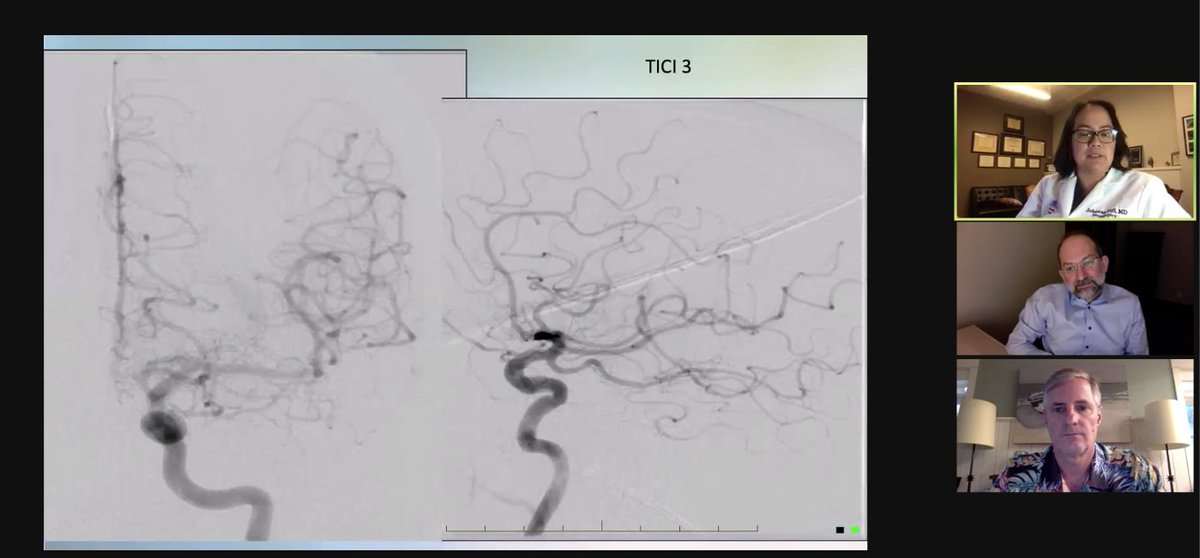 PenNeuro's tweet photo. US HCPs: Thanks for joining #PenNeuro #FirstPassEffect in Real World Cases webinar. @johannatfifi
@donfreimd @CharlesMatouk. #stroke
Rx only. For indications, contraindications, warnings, precautions & potential adverse events see
https://t.co/BeLdB4H8EZ Clinical results vary https://t.co/I4wsJvF2qX