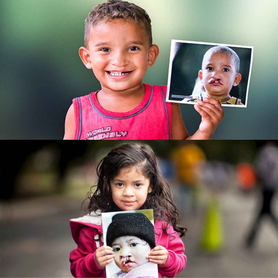 Chris Bertish Foundation tweet media