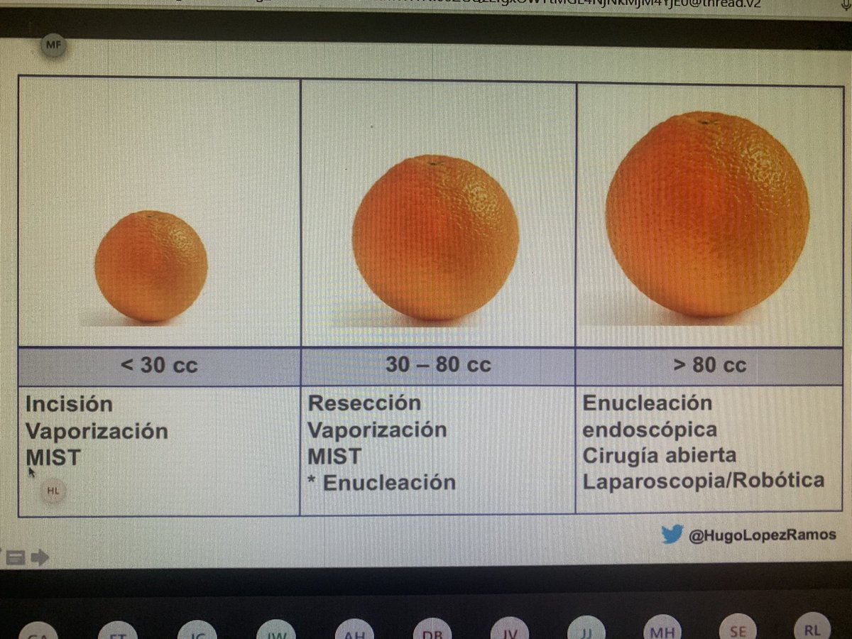 Para nuestro país #Bipolep  la mejor técnica, gracias por compartir su experiencia!!!