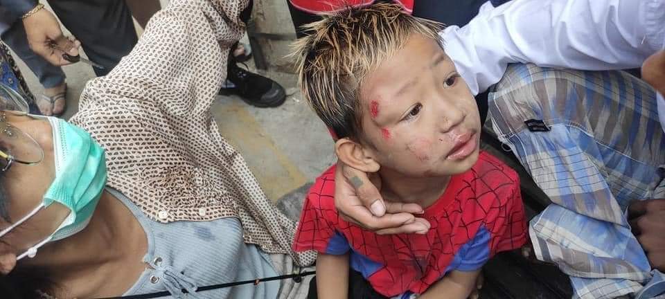 Sai Thura Win (@saithurawin3) on Twitter photo 77thx35th St, Mandalay. Kid was just playing at the road side. Police and military passed by the road and opened fired randomly and he was stricken a glancing blow shot. Our lives are in danger days and nights.
JUNTA BRUTALITY
<a href="/RapporteurUn/">UN Special Rapporteur Tom Andrews</a>
#WhatsHappeningInMyanmar
#Feb26Coup 77thx35th St, Mandalay. Kid was just playing at the road side. Police and military passed by the road and opened fired randomly and he was stricken a glancing blow shot. Our lives are in danger days and nights.
JUNTA BRUTALITY
<a href="/RapporteurUn/">UN Special Rapporteur Tom Andrews</a>
#WhatsHappeningInMyanmar
#Feb26Coup