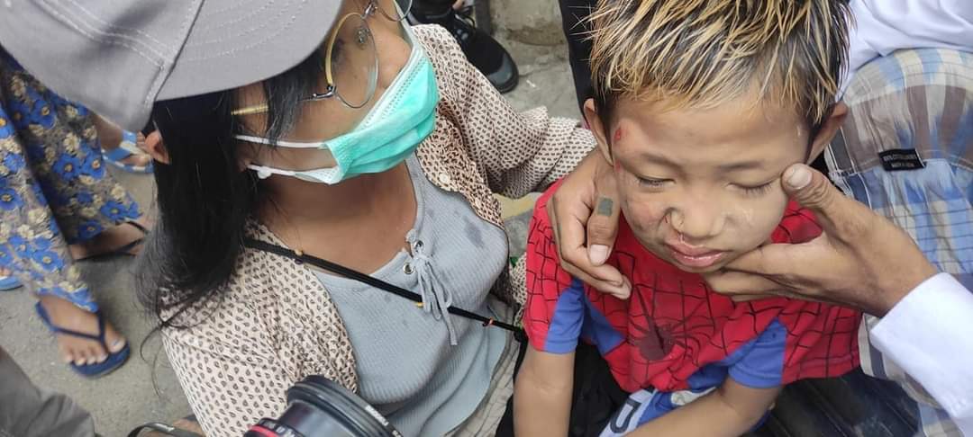 Children are being attacked by military.
#WhatsHappeninglnMyanmar 
#Feb26Coup