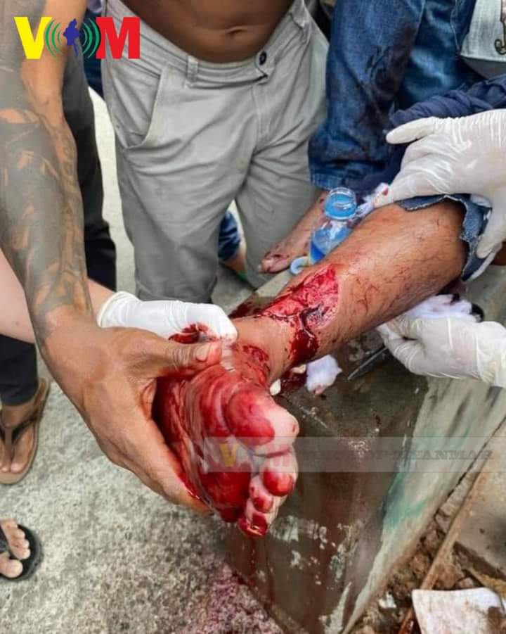 marn_khin's tweet photo. TW:Blood:Gunshots
Police and soldiers are chasing and shooting everyone on the streets of Mandalay. 
JUNTA BRUTALITY #WhatsHappeningInMyanmar #Feb26Coup https://t.co/4xHB6iWVjE