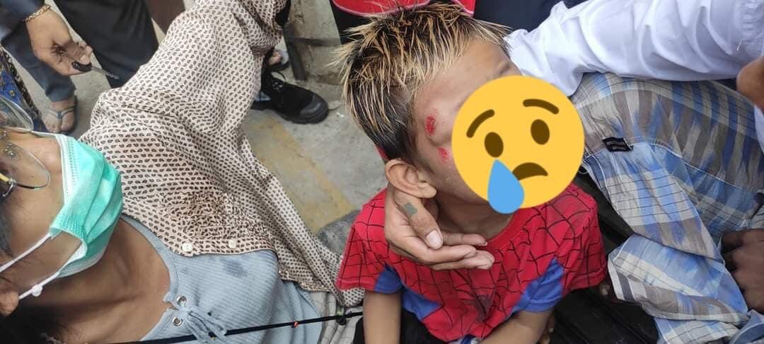 The military shot the stones with slingshot into the crowd of residents and one young child got injuried in the forehead!The brutal crackdown has been happening in Myanmar nationwide!
#WhatsHappeningInMyanmar
#Feb26Coup
#MilkTeaAlliance 
#OpCCP