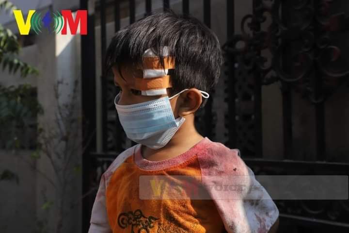 Phyo Phyo Aung (@phyophyoaungmm) on Twitter photo TW//Blood
JUNTA BRUTALITY
Myanmar Military attacked even the children who are not protesting in Mandalay today. Please take action for these violation. <a href="/UNHumanRights/">UN Human Rights</a>
<a href="/RapporteurUn/">UN Special Rapporteur Tom Andrews</a>
#Feb26Coup
#WhatsHappeningInMyanmar TW//Blood
JUNTA BRUTALITY
Myanmar Military attacked even the children who are not protesting in Mandalay today. Please take action for these violation. <a href="/UNHumanRights/">UN Human Rights</a>
<a href="/RapporteurUn/">UN Special Rapporteur Tom Andrews</a>
#Feb26Coup
#WhatsHappeningInMyanmar
