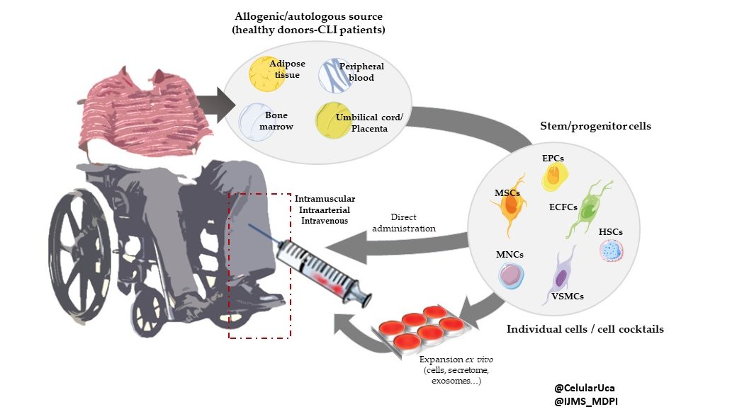 CellTherapy82's tweet photo. Glad to share our latest review about the application of Cell Therapy in #CriticalLimbIschemia, in the Special Issue "Arteriogenesis and Therapeutic Angiogenesis" @IJMS_MDPI @LuciaBeC @MCDuran10 @CelularUca @univcadiz #INIBICA #celltherapy  

https://t.co/AYtlav3Ku9 https://t.co/3kPnTc9jrz