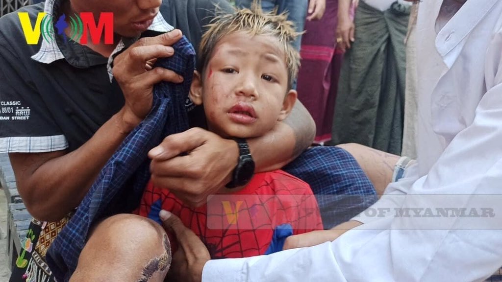 TW \\ Violence
RIOT POLICE attack at Childs?
How many innocent lives UN?
<a href="/UN/">United Nations</a> 
#WhatsHappeningInMyanmar 
#MilkTeaAlliance 
#Feb26Coup