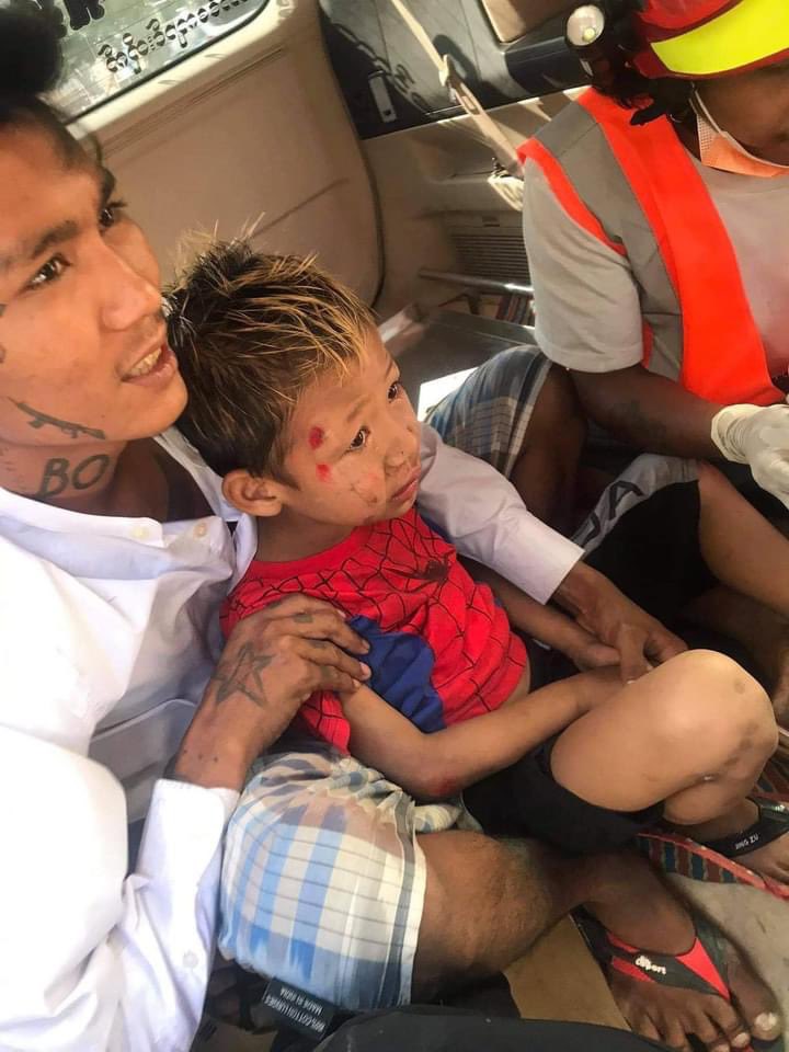 Happening now in Mandalay ,Myanmar. This young innocent boy was hurt by one of the slingshots that the military used to attack the civilians.He could have even gone blind by their random shots. Please take action of this inhumanity.<a href="/freya_cole/">Freya Cole</a> @Feb26coup #WhatsHappeningInMyanmar