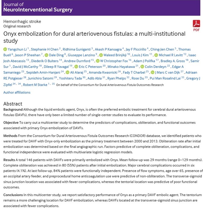 MULTICENTER STUDY DURAL CEREBRAL ARTERIOVENOUS FISTULA EMBOLIZATION. Great team effort by CONDOR assessing long term outcomes of embolization of DAVF. 

jnis.bmj.com/content/early/…