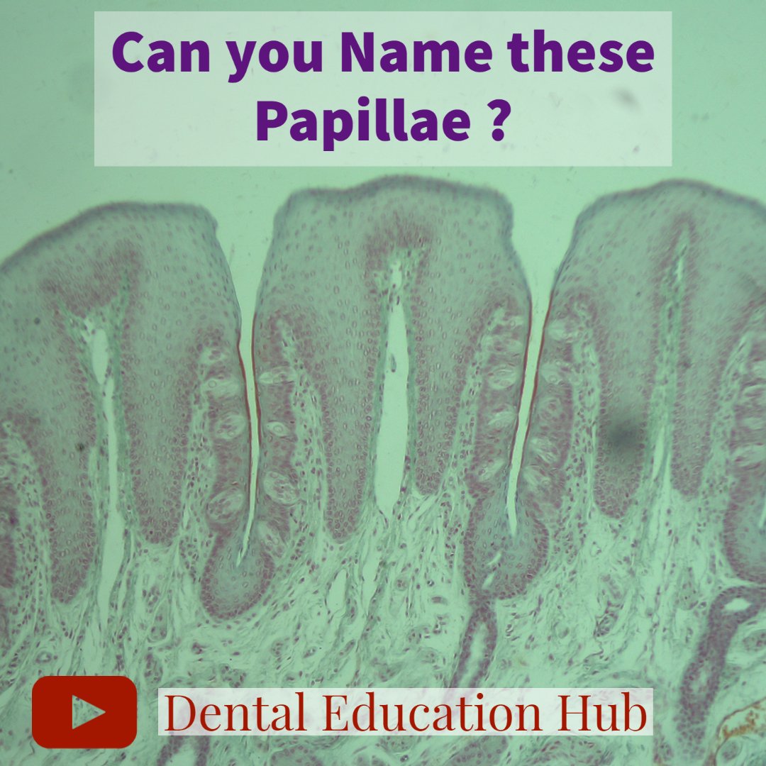 dentaleduhub's tweet photo. Can you name these papillae present on the dorsal surface of tongue 👅🔬?
#dentaleducationhub #dentaleducation #dentalnotes #dentistry #histology #histologylab #oralbiology #chulalongkornuniversity #mahidoluniversity #chiangmaiuniversity #medicaleducation https://t.co/be8EBqdIUk