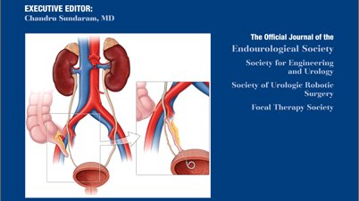 Aeen Asghar MD (@aeen_a) on Twitter photo Excited to be featured on the cover of <a href="/JEndourology/">Journal of Endourology</a> for our work on robotic management of radiation-induced ureteral strictures doi.org/10.1089/end.20…
<a href="/md_eun/">Daniel D Eun MD</a> <a href="/TempleUrology/">Temple Urology</a> <a href="/ZLeeGU/">Ziho Lee</a> <a href="/RandallsPlaque/">Randall Lee MD</a> <a href="/SteinStraussen/">David Strauss</a> <a href="/NYUUrology/">NYU Langone Urology</a> @HUMGUrology
#CORRUS
Also doi.org/10.1016/j.urol… Excited to be featured on the cover of <a href="/JEndourology/">Journal of Endourology</a> for our work on robotic management of radiation-induced ureteral strictures doi.org/10.1089/end.20…
<a href="/md_eun/">Daniel D Eun MD</a> <a href="/TempleUrology/">Temple Urology</a> <a href="/ZLeeGU/">Ziho Lee</a> <a href="/RandallsPlaque/">Randall Lee MD</a> <a href="/SteinStraussen/">David Strauss</a> <a href="/NYUUrology/">NYU Langone Urology</a> @HUMGUrology
#CORRUS
Also doi.org/10.1016/j.urol…