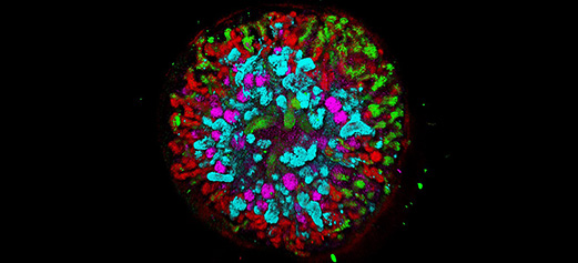 CellPressNews's tweet image. What’s next in the field of #organoids and #organengineering? Find out at #CellSymposiaExpress #CSOrganoids2021 – April 26, 2021, 12PM ET. Register for free: hubs.ly/H0G_K840 hubs.ly/H0G_K850
