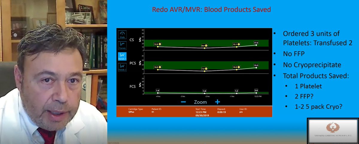 HemoSonics's tweet image. The latest @Stago_Official webinar on #GoalDirected #BleedingMgmt in #CardiacSurgery using the Quantra® #Hemostasis Analyzer is now available on-demand: stagowebinars.com/replay.php?idw… #coagulation #platelets #fibrinogen #heparin #bloodproducts