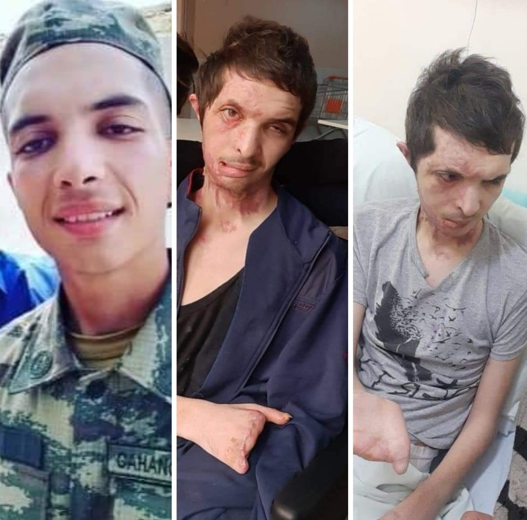 Müharibədən əvvəl və sonra. 
Əvvəl hamı onu axtarırdı, əsgərliyə ordan da müharibəyə aparmaq üçün. 
Amma indi onu nə axtaran, nə də maraqlanan var...