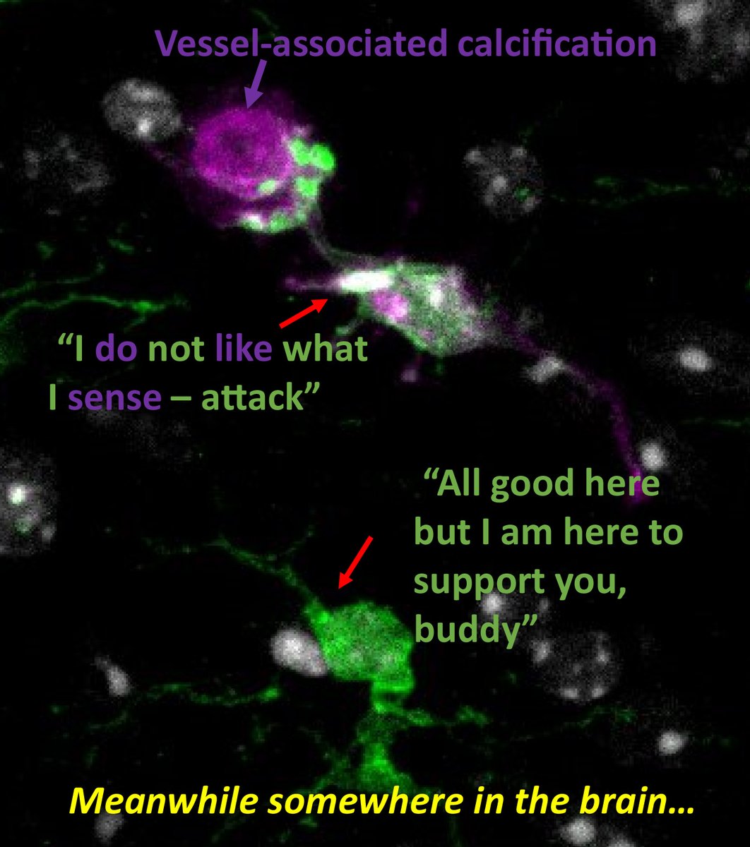 akellerlab's tweet photo. Look at this fierce warrior #microglia attacking a budding, small #calcification on the blood vessel (image credit: @suchetasridhar)! Would like to know more? Check out our latest paper!
https://t.co/MGmJP47xBk
Tremendous work conducted by the inimitable  @ZarbYvette, lab alumni https://t.co/IOkRiwy0MB