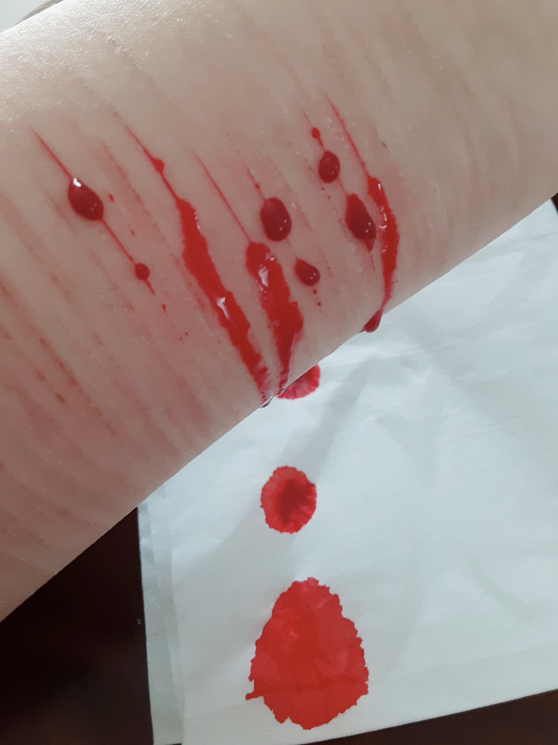 にゅ ﾒﾝﾍﾗﾁｬﾝ ざくざく リスカ メンヘラ女子 メンヘラさんと繋がりたい メンヘラ メンヘラ女子と繋がりたい アムカ 貝印カミソリ T Co 2rlrromkri Twitter