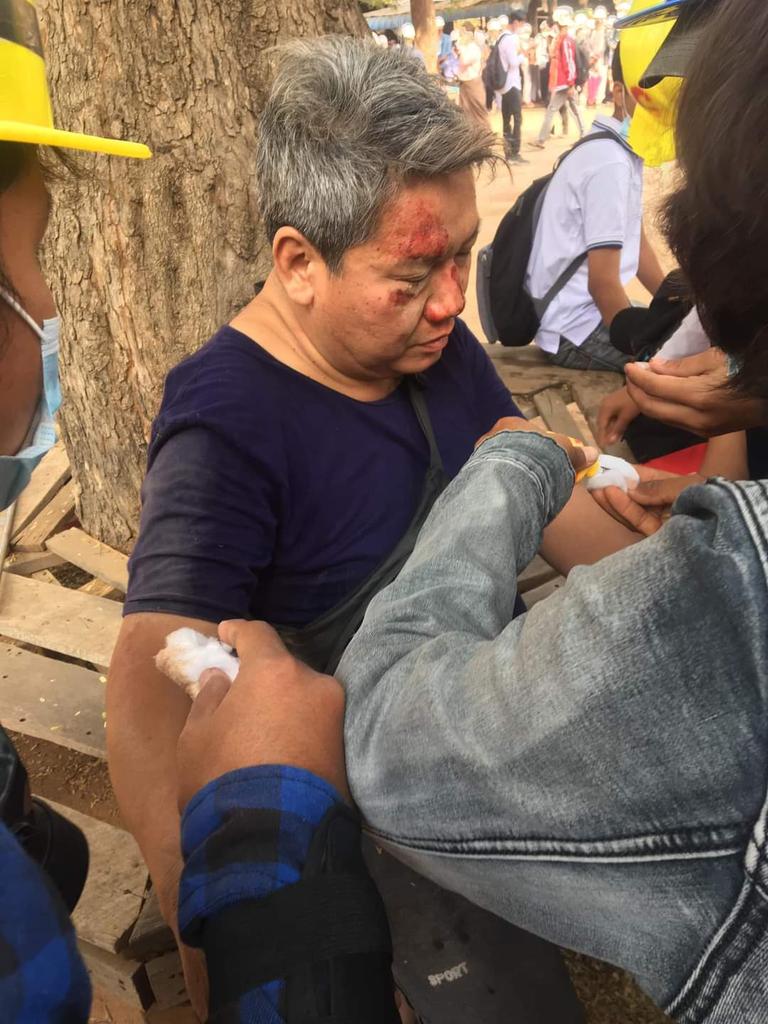 kiera_zat's tweet photo. TW// Blood, Violence
One uncle was beaten during the Monywa strike.
#Feb27Coup
#WhatsHappeningInMyanmar https://t.co/0keQhCBuVq