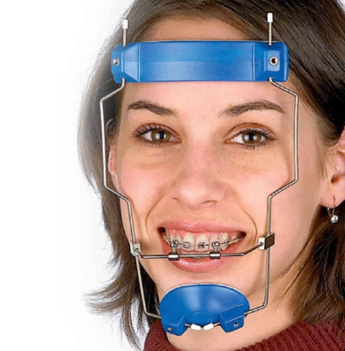 Брекеты с лицевой дугой Headgear