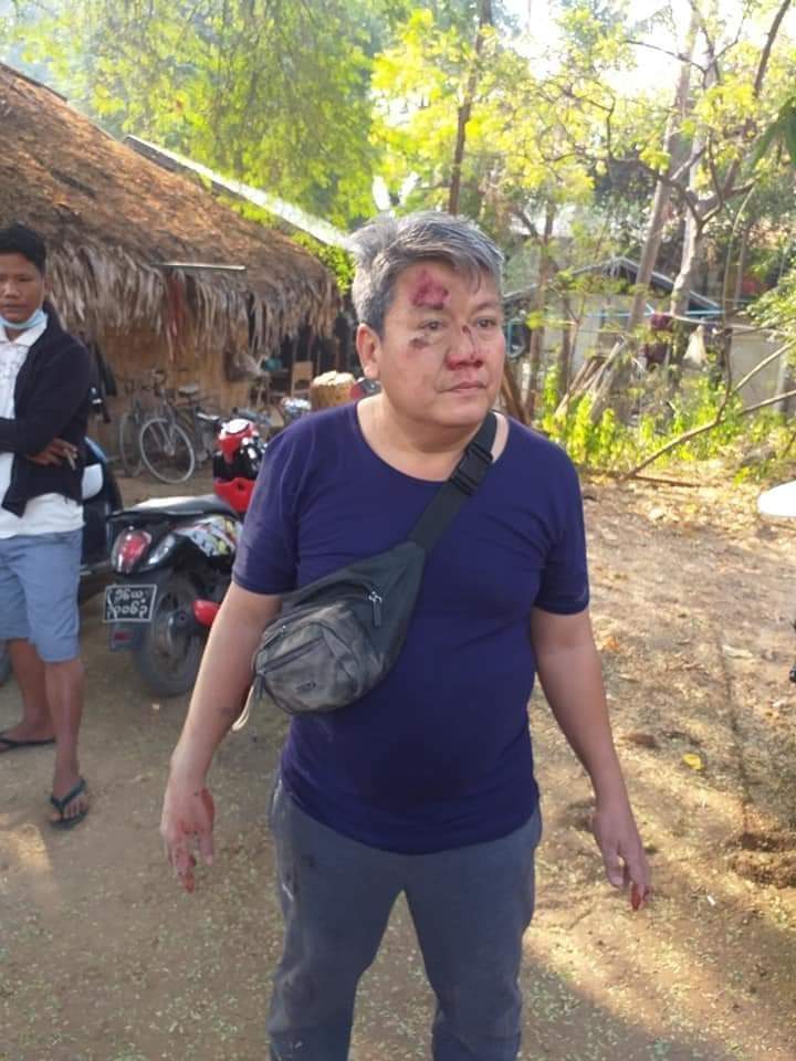 NwayOoKhin8's tweet photo. This is how the military treats people in MYANMAR❗
Soldiers in civilian clothes were beating and arresting some people. 
Breaking the Laws and arresting Innocent ppl❓@UN_HRC @cvoule @RapporteurUn @TostevinM @KenRoth @freya_cole
CRPH ASSEMBLE
#WhatsHappeningInMyanmar
#Feb27Coup https://t.co/Vib4lGt7b9