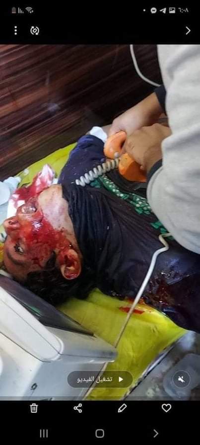 أيها البابا فرنسيس <a href="/Pontifex_ar/">البابا لاون الرابع عشر</a>
انت رجل تحب السلام ولكن انت قادم لمقابله حكومه تقتل الأطفال من دون رحمه
هل يقبل ضميرك أن تقابل قتله ومجرمين