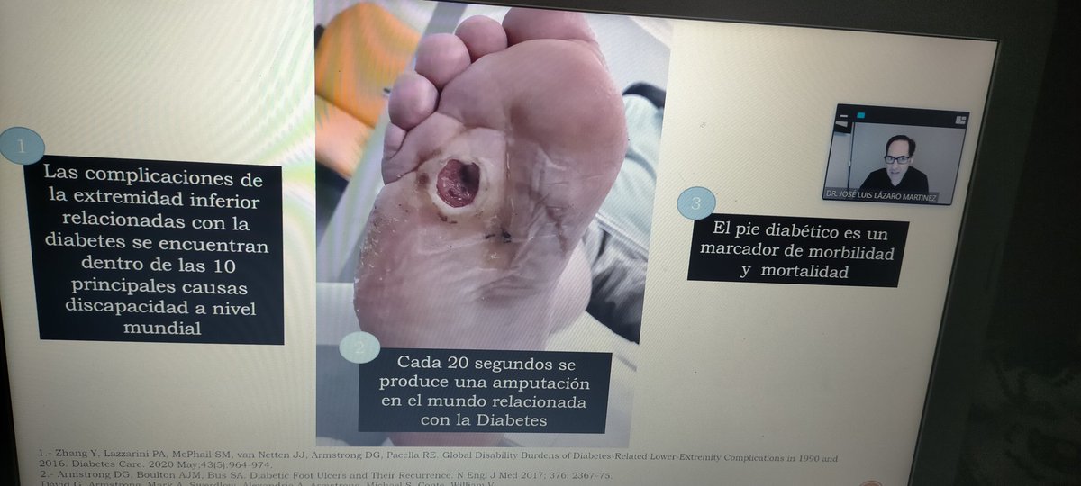 EnarRoGon's tweet photo. Magnifica Prime Weekend de @PHerbitas siempre es un placer escuchar a @JosLuisLzaroMa1 hablando sobre la prevención y el manejo del pie diabético siguiendo las guías del IWGDF. https://t.co/kUfrECT6bC
